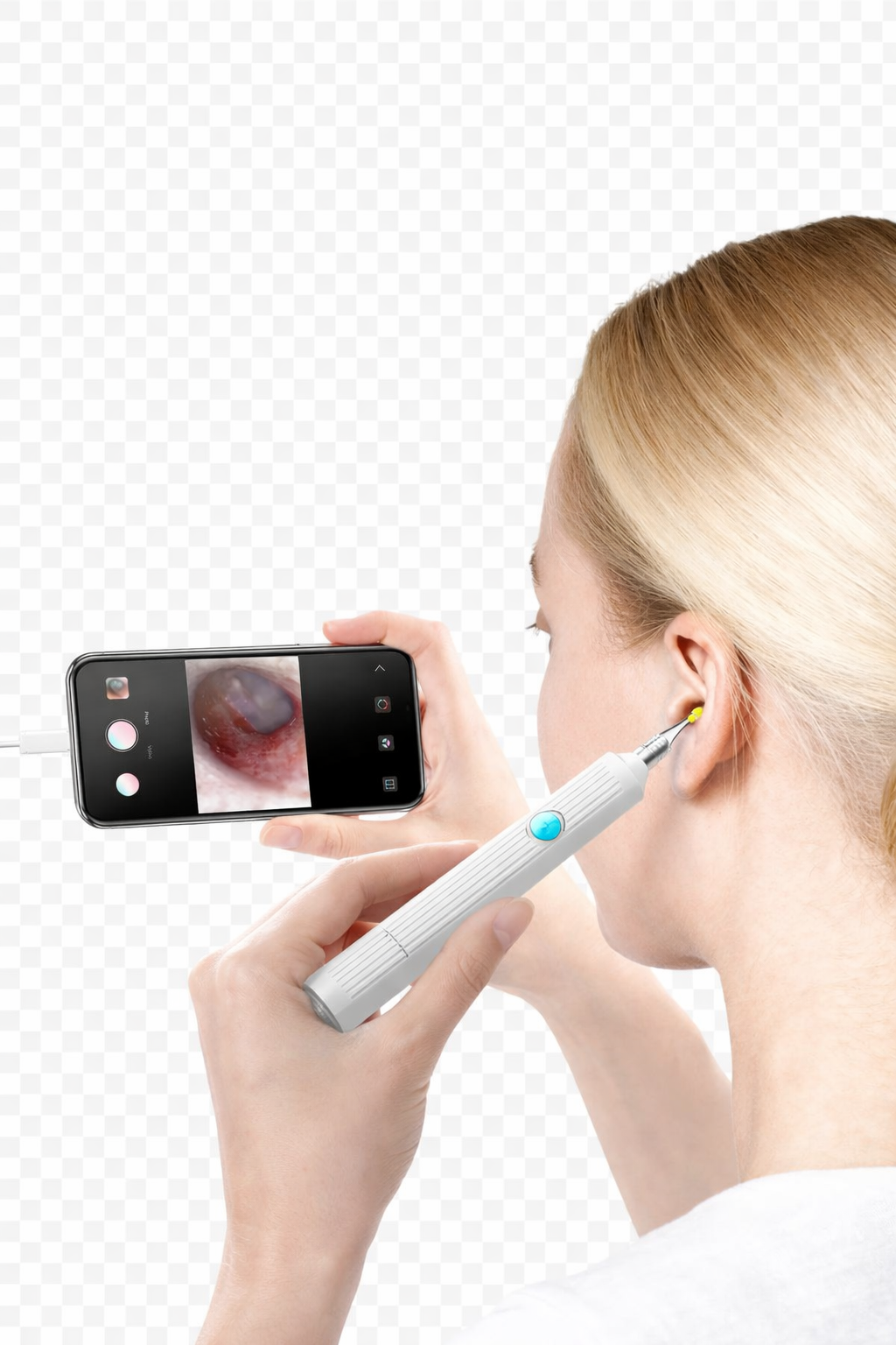 VIOTORI Ear Wax Removal